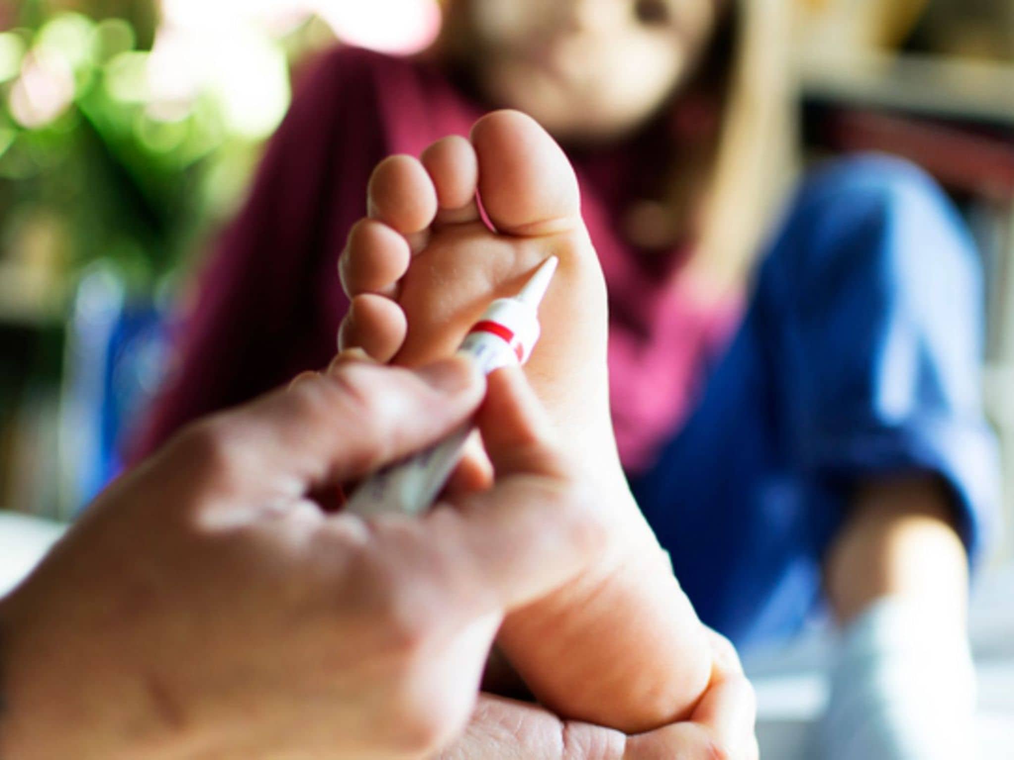 Warzen bei Kindern: ein Elternteil trägt ein Warzenmittel auf die Fußsohle des Kindes auf