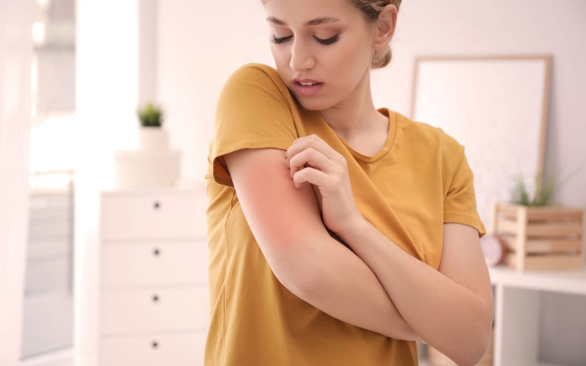 Abb_Hautroetung_Allergie_1800x1200_acf_cropped