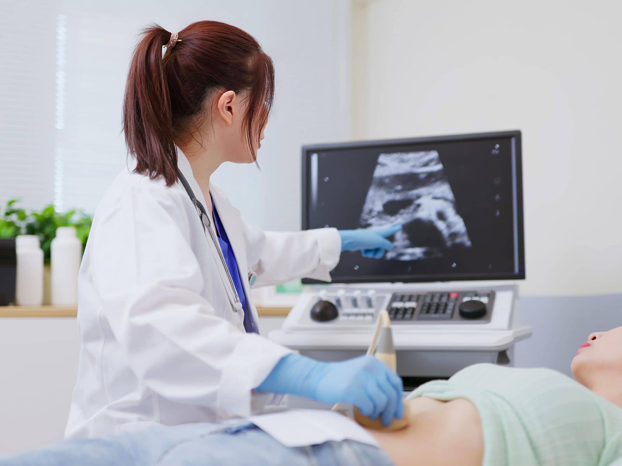 Myome: Eine Gynäkologin untersucht eine Frau mit einem Ultraschallgerät und zeigt ein Myom in der Gebärmutter