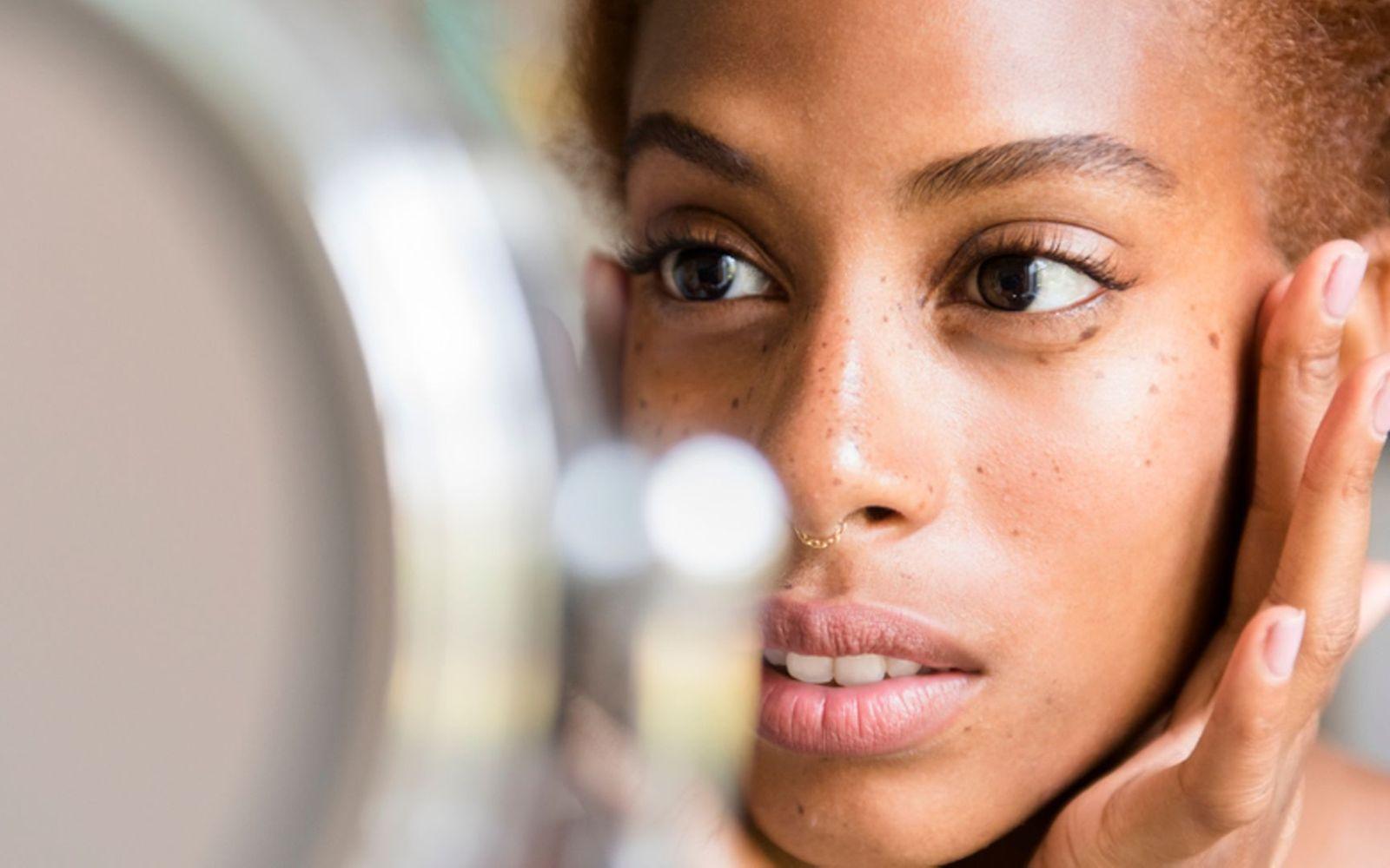Pigmentstörungen: Junge Frau betrachtet im Spiegel ihr Gesicht