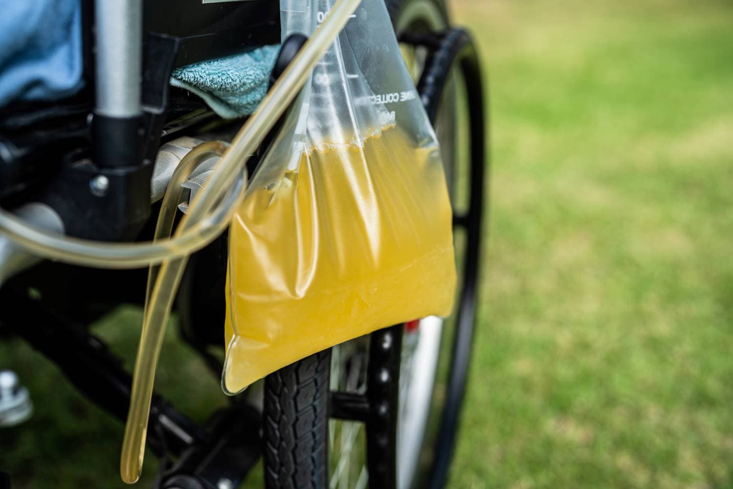 Ableitende Inkontinenzhilfen: An einem Rollstuhl ist ein Urinbeutel mit Schlauch befestigt.