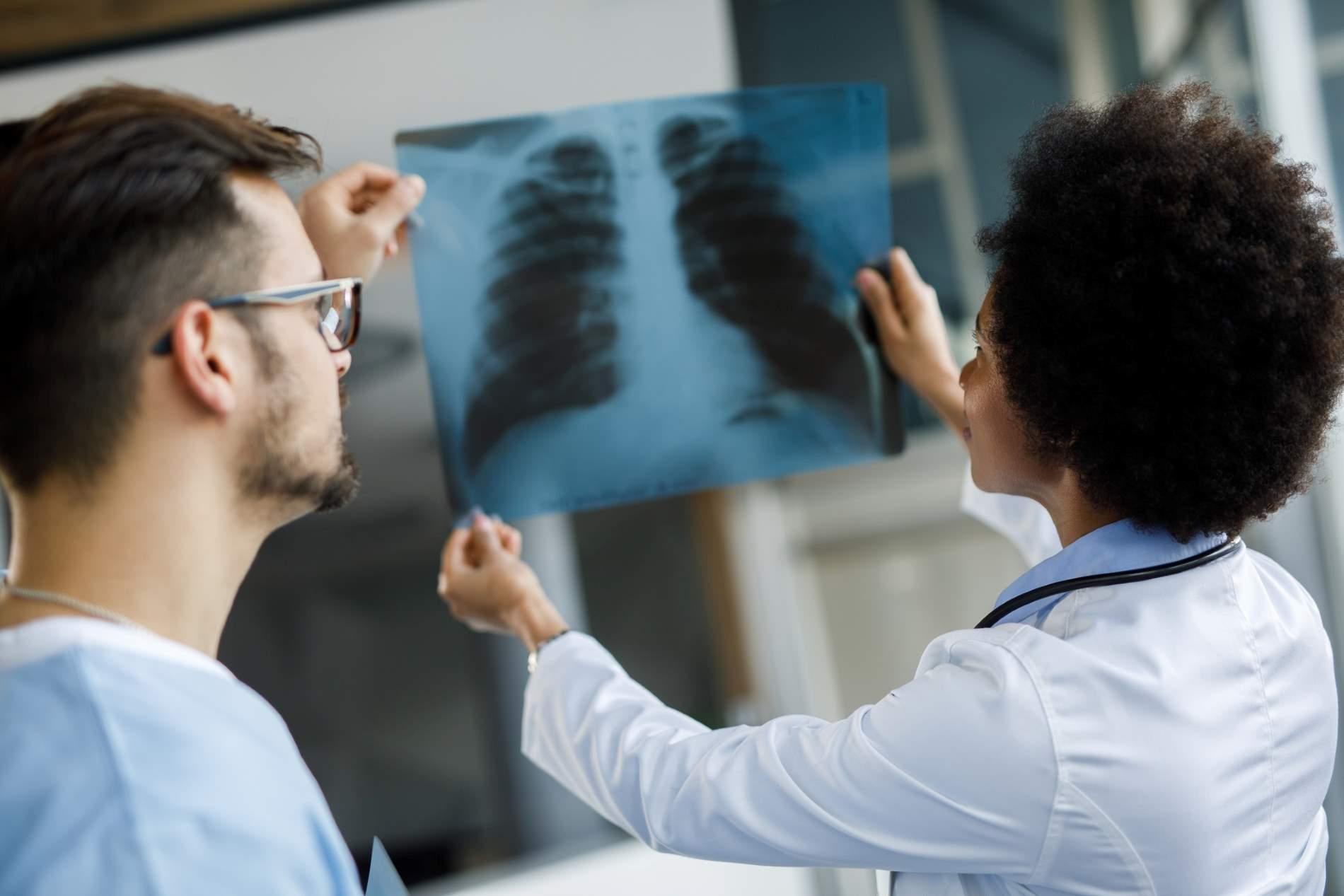 Röntgenpass: Ein Mann und eine Frau betrachten ein Röntgenbild. 