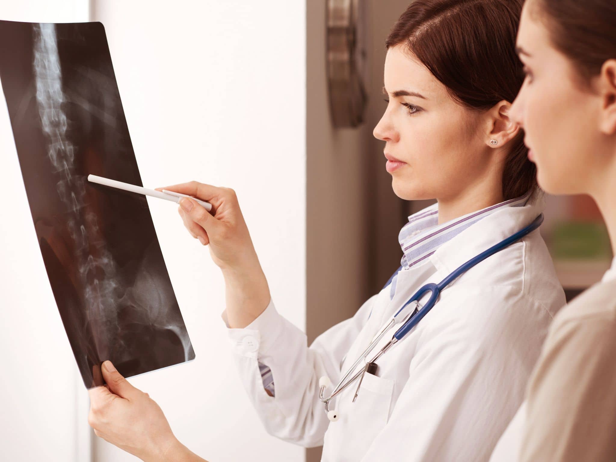 Frauen Röntgenbild Wirbelsäule