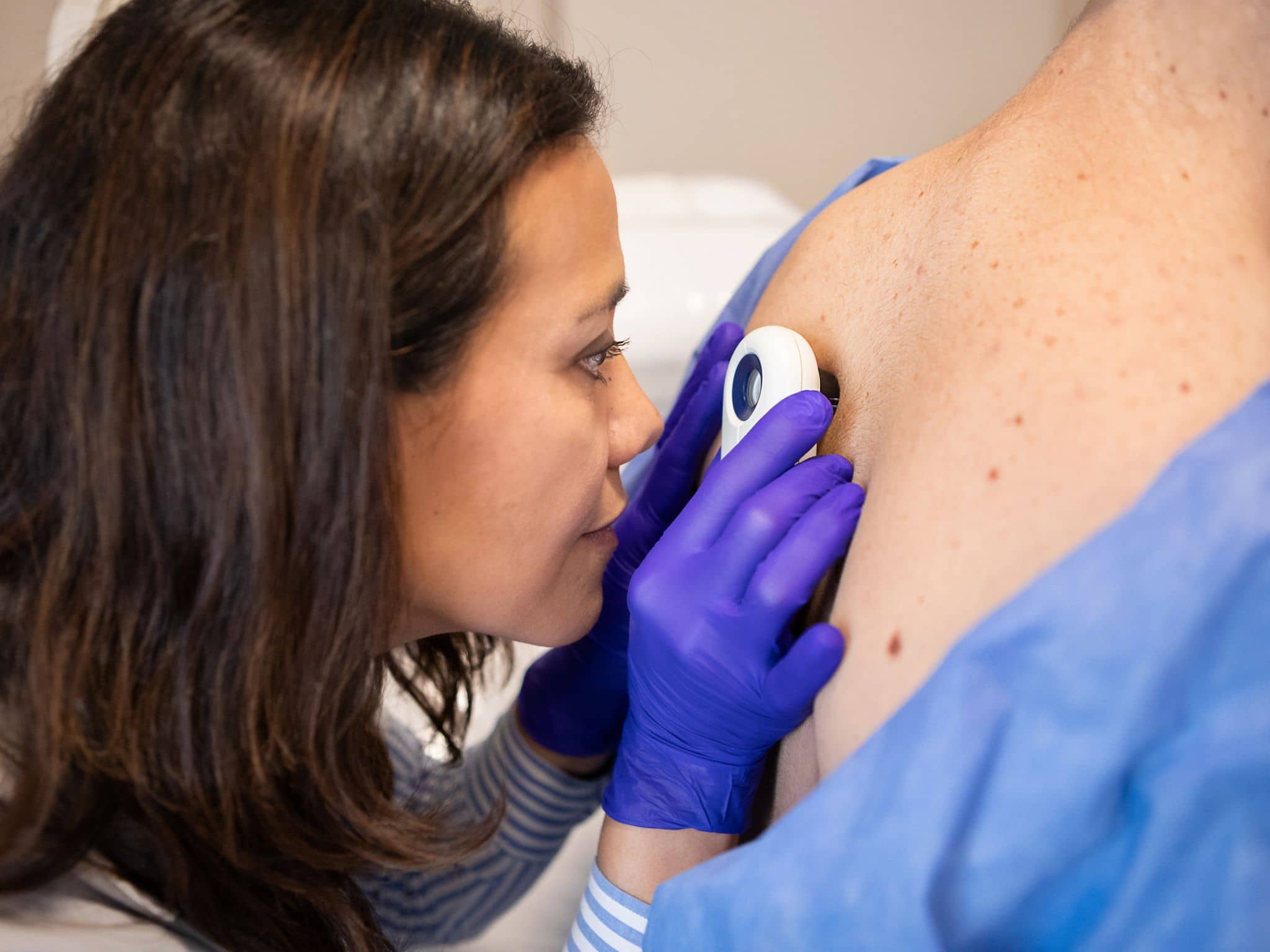 Hautkrebs erkennen-ruizluquepaz-GettyImages-2155223391