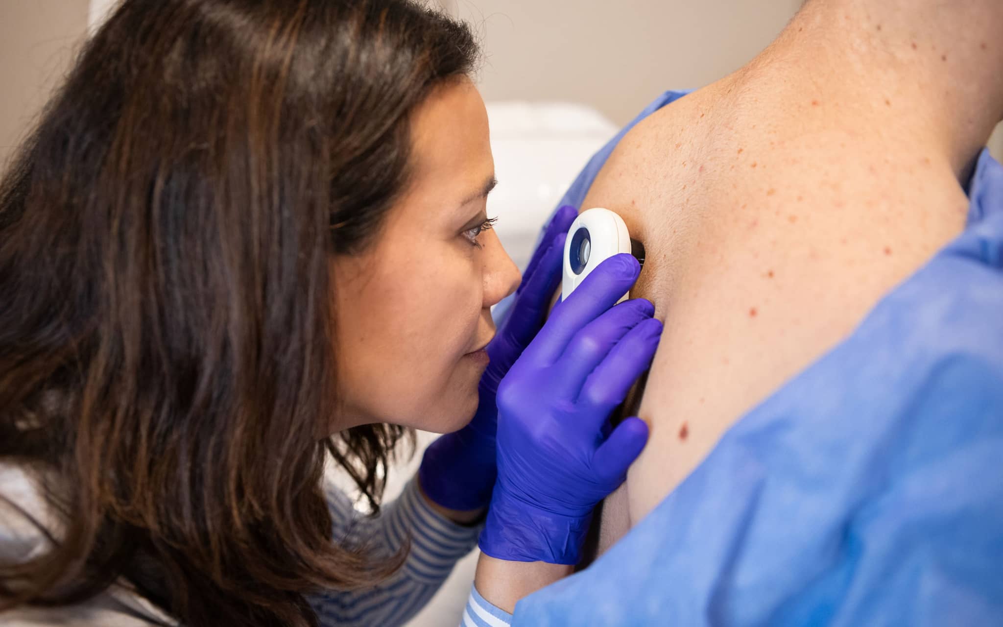 Hautkrebs erkennen-ruizluquepaz-GettyImages-2155223391