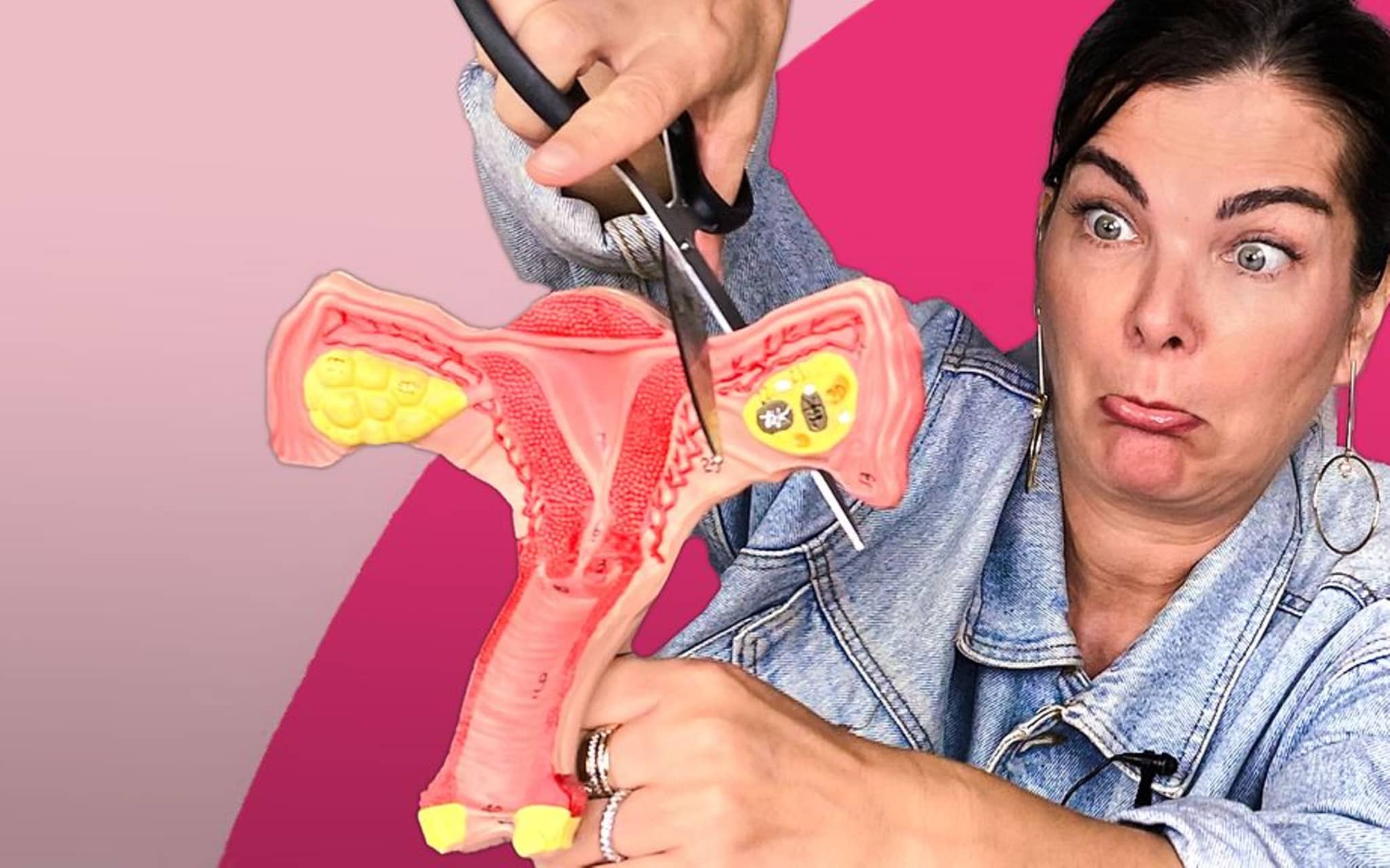 Symbolbild Sterilisation der Frau