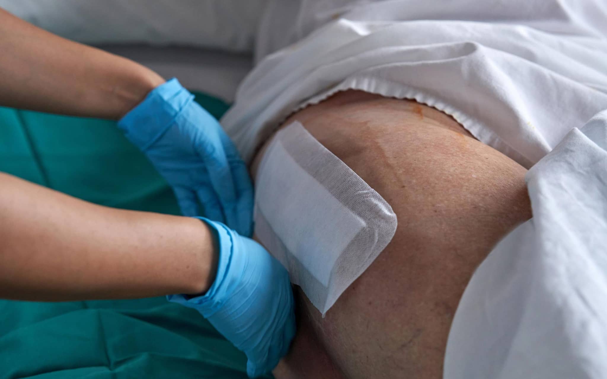 Versorgungsreport: Die Hände einer Krankenpflegerin legen am Bein eines Patienten ein Wundpflaster an.