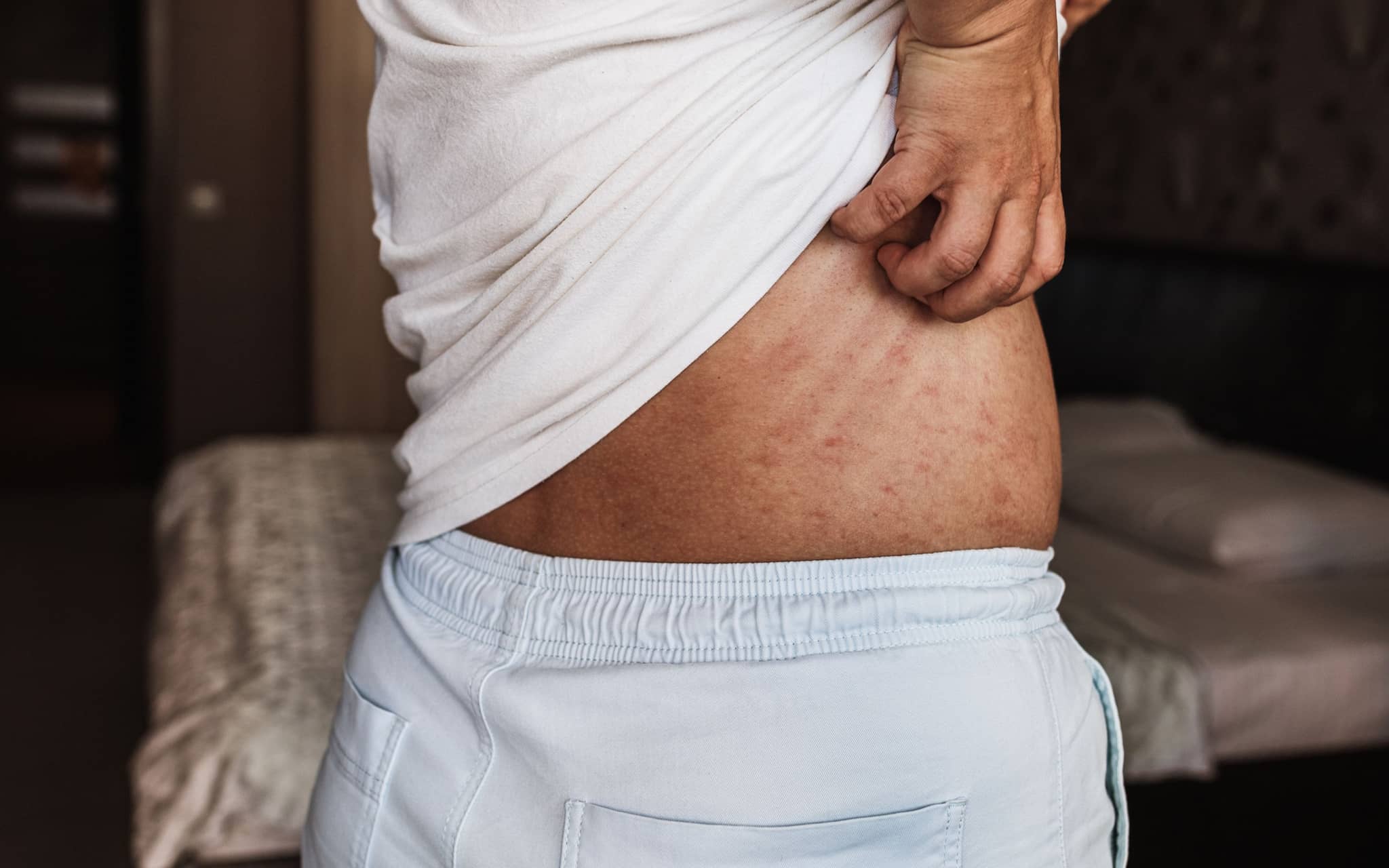 Bild: Frau hebt ihr T-Shirt um sich am Rücken zu kratzen.